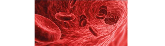 Blocked arteries can result in high blood pressue. Representation of an artery